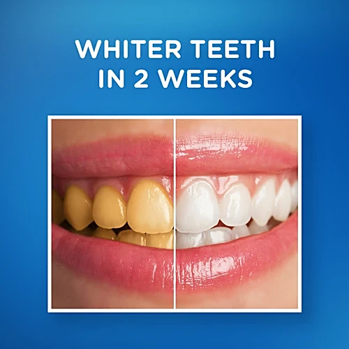Pepsodent Whitening Toothpaste, 150 g