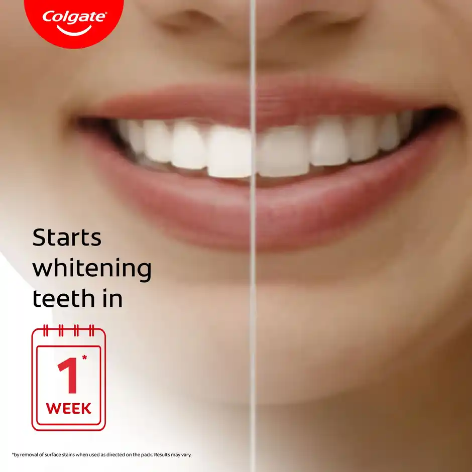 Colgate Visible White Sparkling Mint Toothpaste, 120 g
